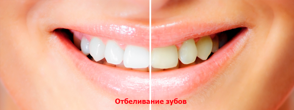 Slideshow Image 2